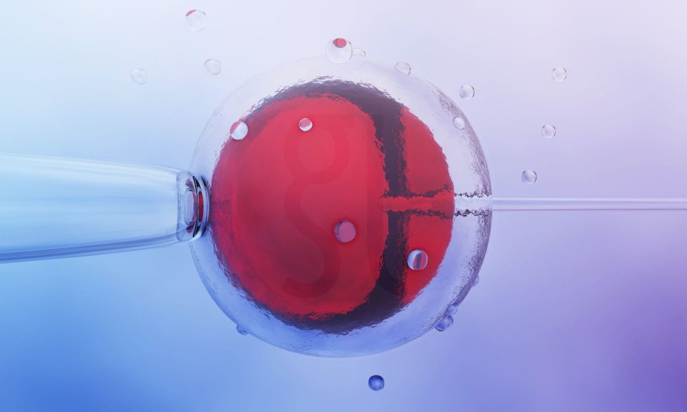 Τι είναι η IVF Ένας πλήρης οδηγός για την εξωσωματική γονιμοποίηση