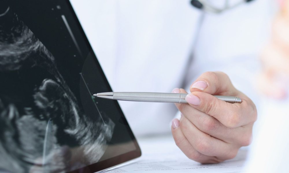 fertility cyprus ivf