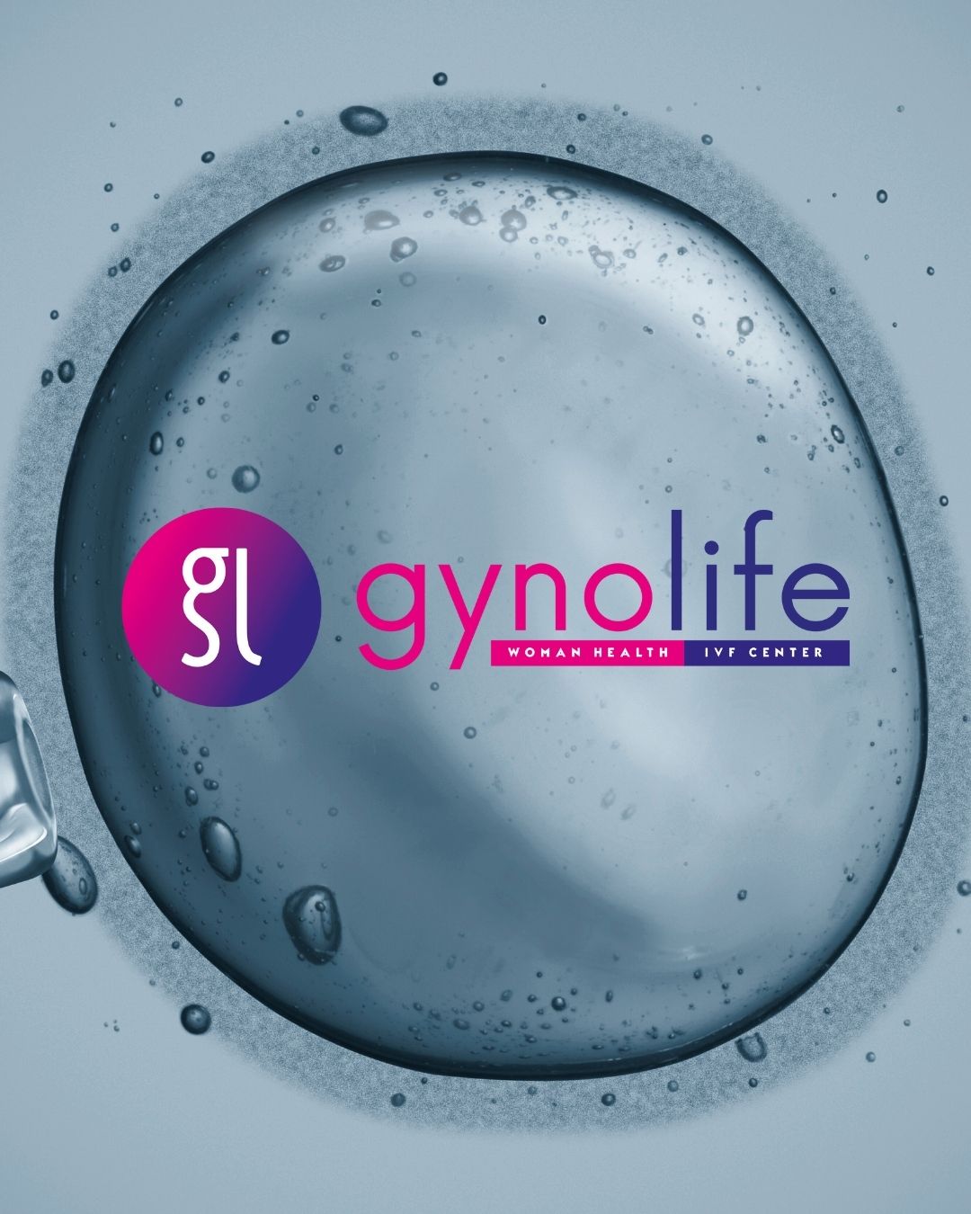 ivf γονιμότητα Κύπρος